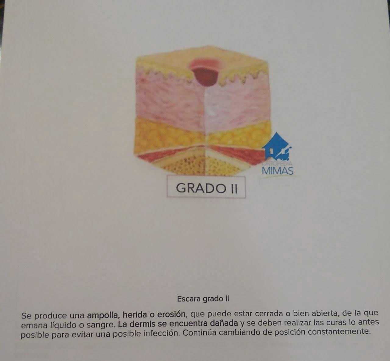 Segunda etapa