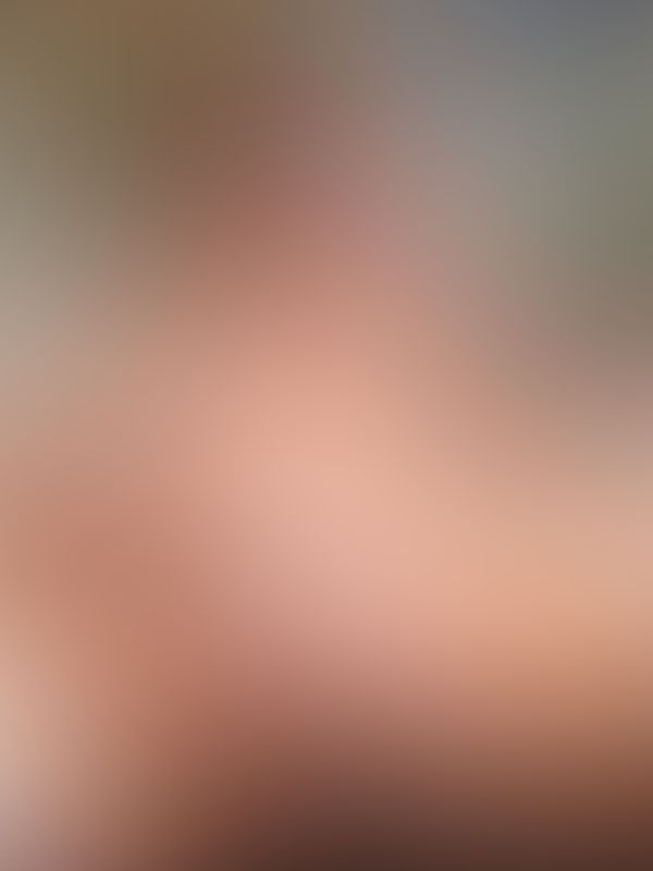 🙈