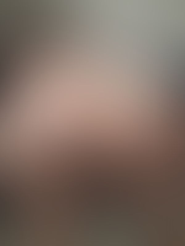Pic 1